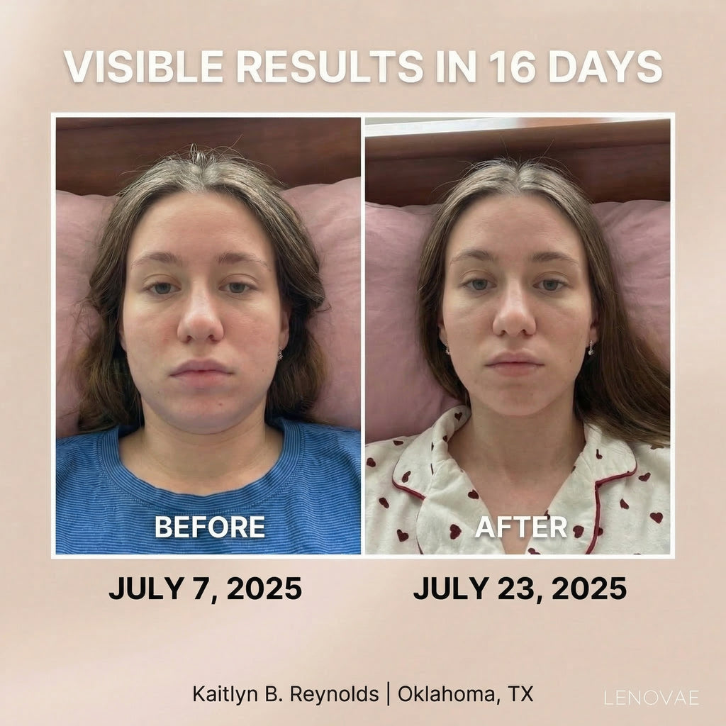 LENOVAE™️ VIRAL 4-IN-1 FACE SCULPTOR