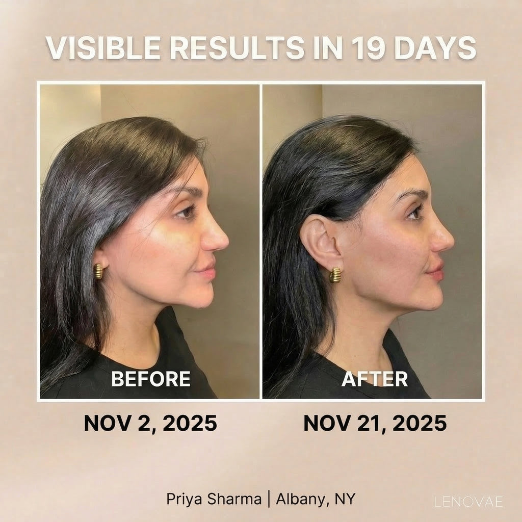 LENOVAE™️ VIRAL 4-IN-1 FACE SCULPTOR