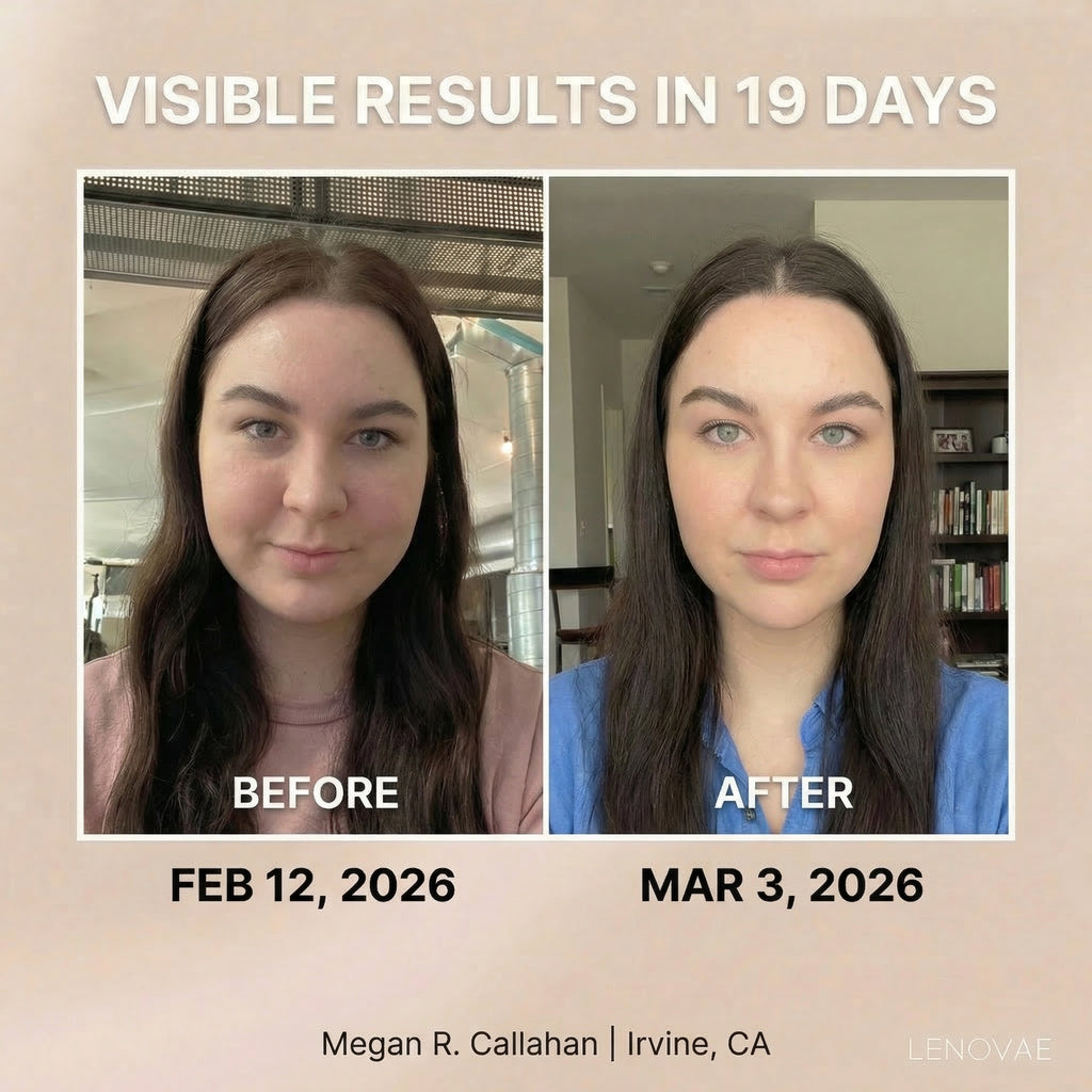 LENOVAE™️ VIRAL 4-IN-1 FACE SCULPTOR