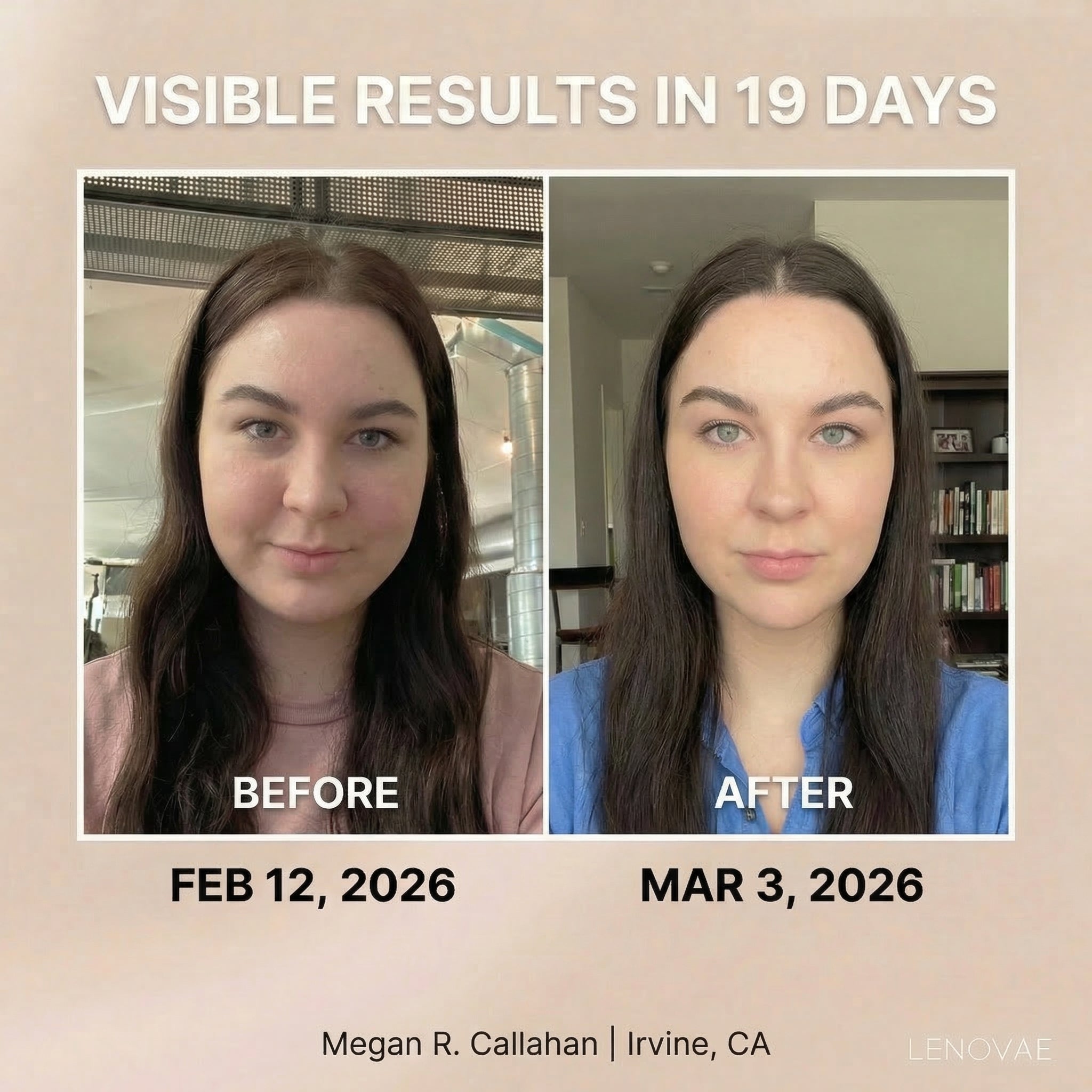 LENOVAE™️ VIRAL 4-IN-1 FACE SCULPTOR