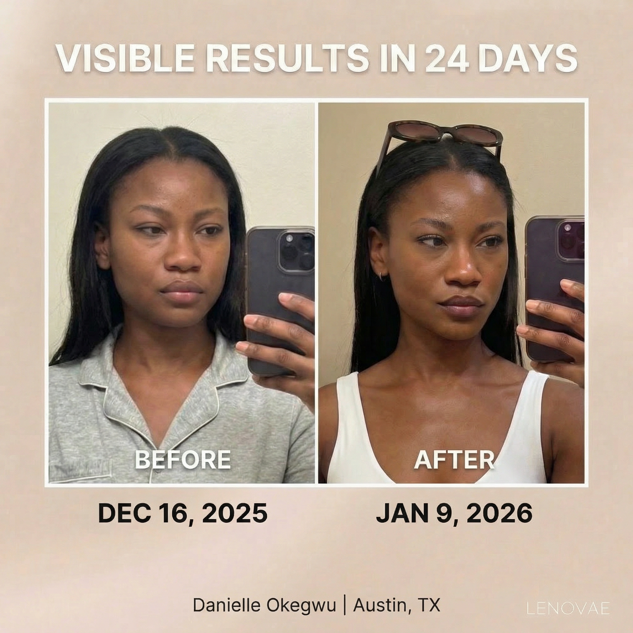 LENOVAE™️ VIRAL 4-IN-1 FACE SCULPTOR